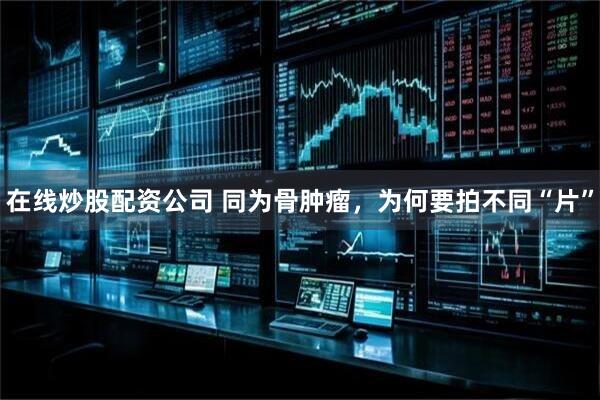 在线炒股配资公司 同为骨肿瘤，为何要拍不同“片”